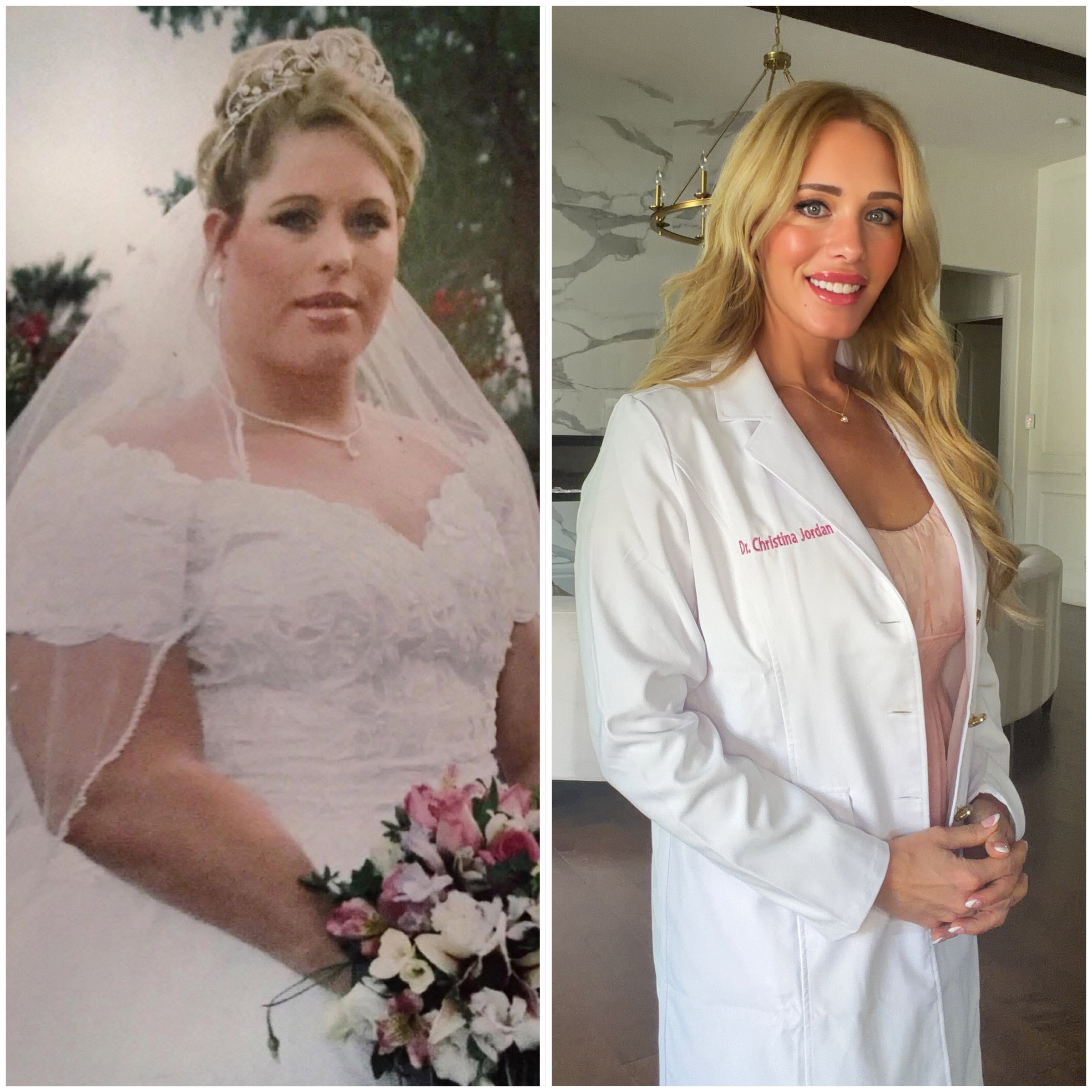 Dr. Christina Jordan Before & After